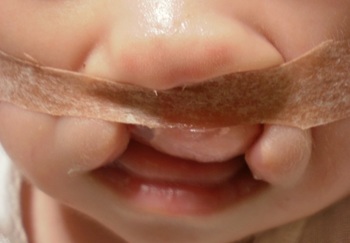 重度の口唇口蓋裂で生まれた我が子 手さぐりでの生活 123ish 日本